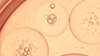 EuBioX Bio-Automation System application in EuLV systems